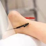 Electroacupuncture: Ancient Wisdom, Modern Current